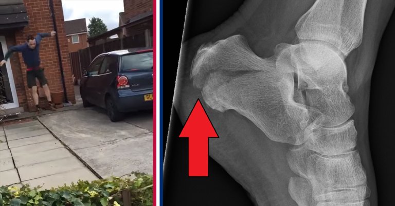 This is the injury that Jodies everywhere should fear